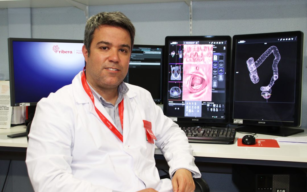El Anillo Radiológico de Ribera integra ocho hospitales del grupo con los mejores especialistas por órgano sistema